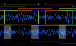 Featured image of post Time Scale Modification Algorithms