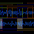 Time Scale Modification Algorithms